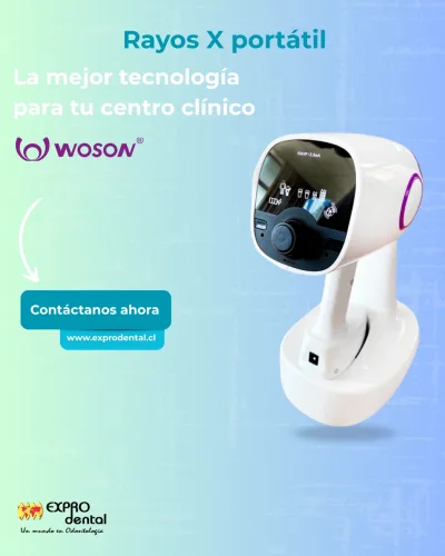 Publicación Instagram lanzamiento de rayos X portátil Woson — Expro Dental